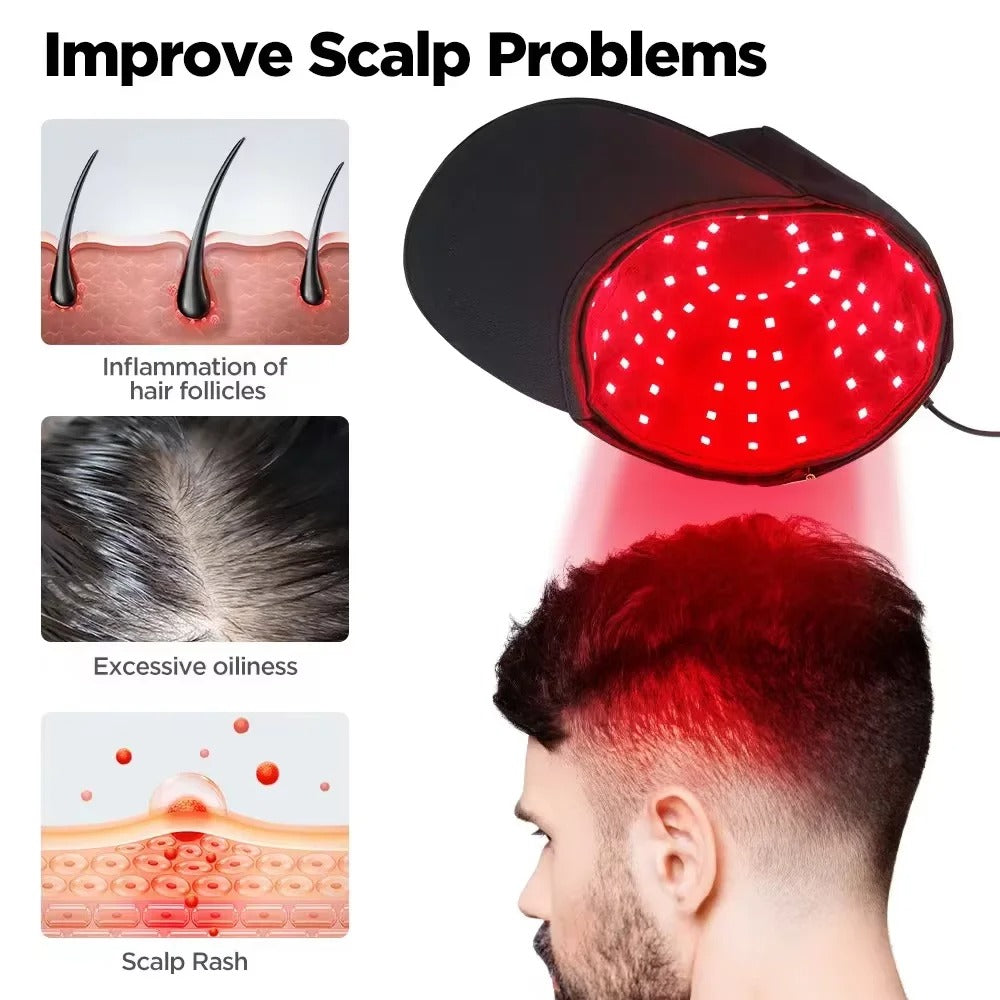 LED helmets/hard hats for hair growth