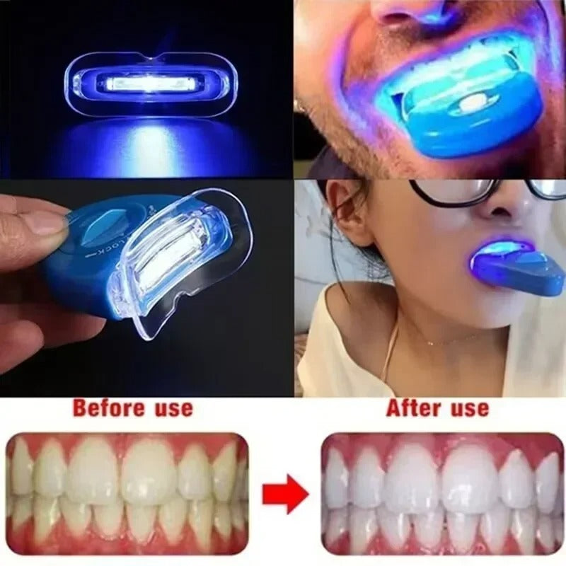 Profession Red Light LED Physiotherapy Device Canker Sore Treat Device Light Therapy Device For Gingivitis Ulcer Oral Problem
