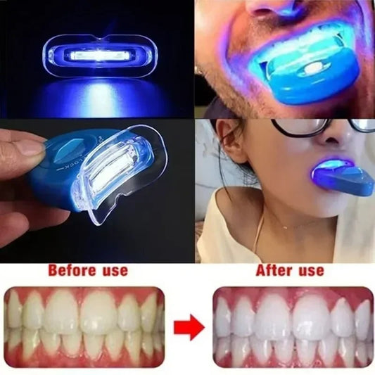 Profession Red Light LED Physiotherapy Device Canker Sore Treat Device Light Therapy Device For Gingivitis Ulcer Oral Problem